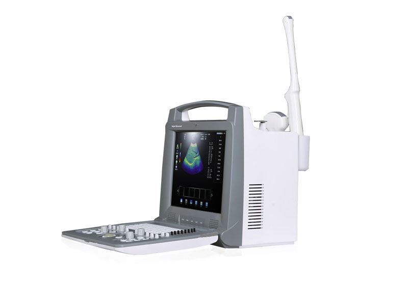 Portable Color Doppler