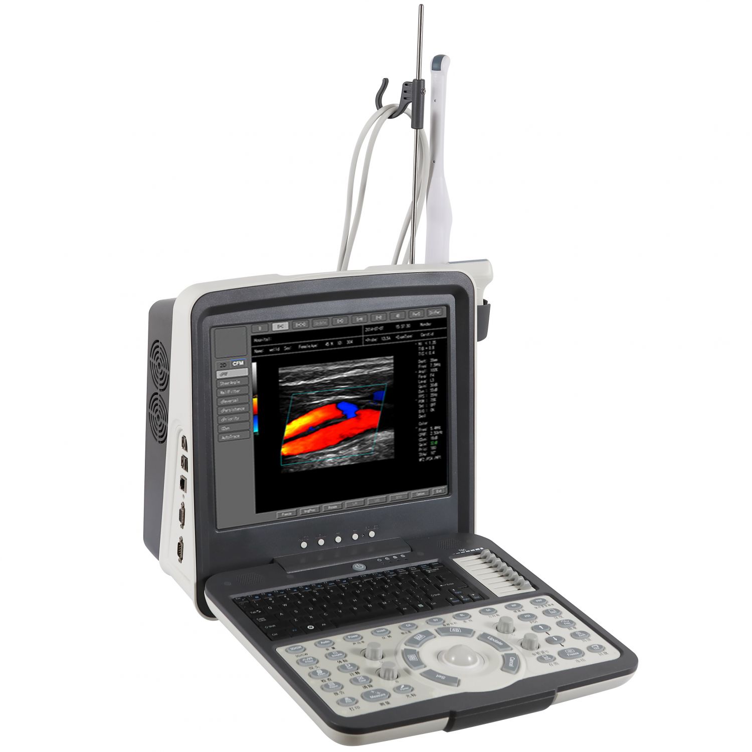 Portable Color Doppler