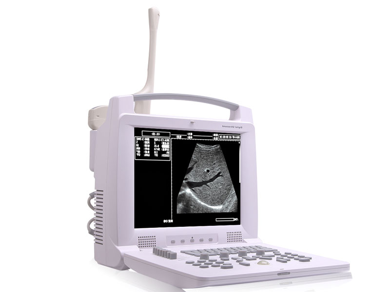 Full Digital Portable Ultrasound Scannerr