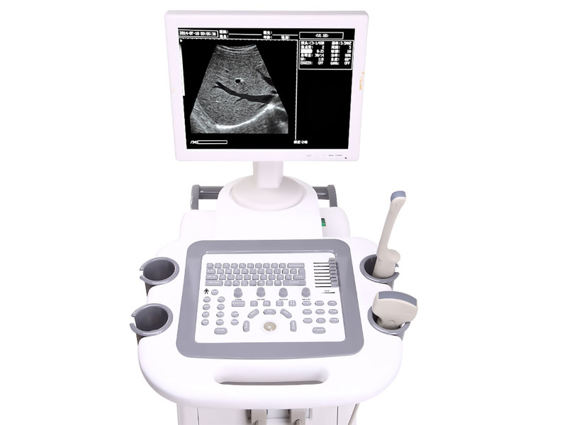 Full Digital Trolley Ultrasound Scanner