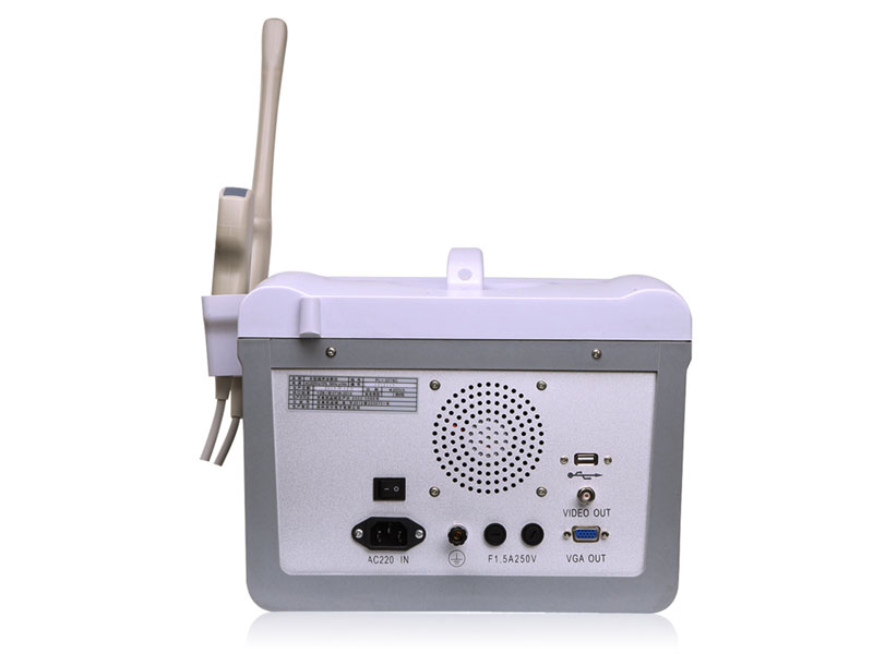 Digital Portable Ultrasound Scanner 