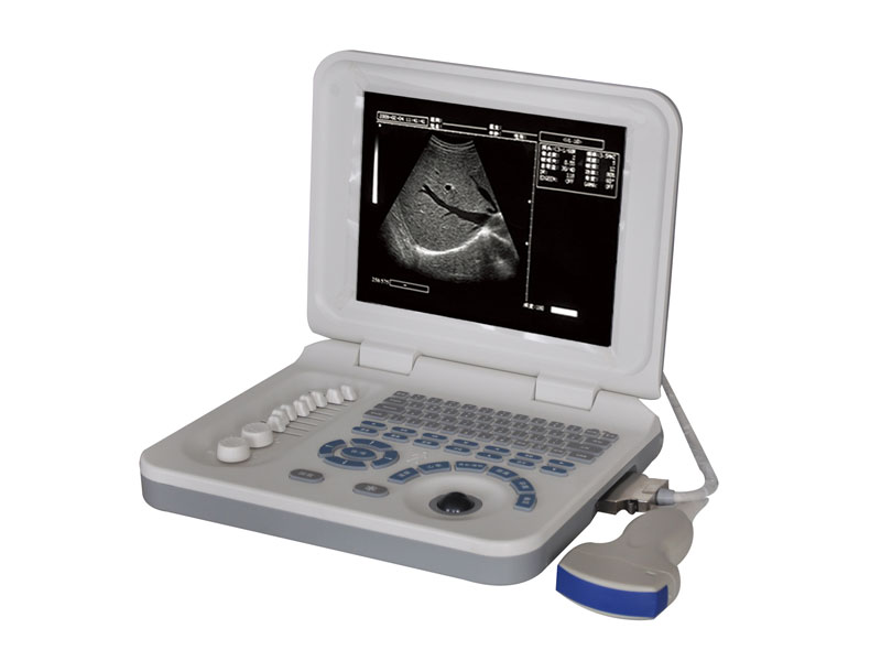 Full Digital Laptop Ultrasound Scanner