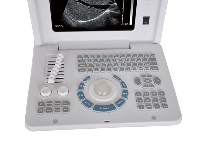 Full Digital Laptop Ultrasound Scanner