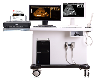 Digital Trolley Ultrasound Scanner