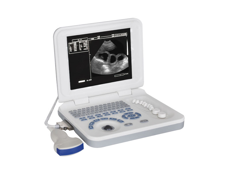 Veterinary Laptop Ultrasound Scanner