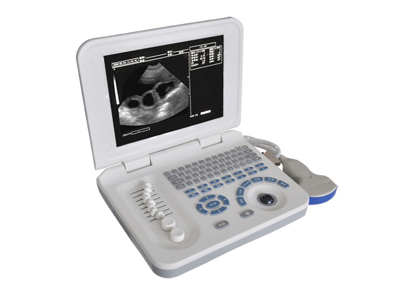 Veterinary Laptop Ultrasound Scanner