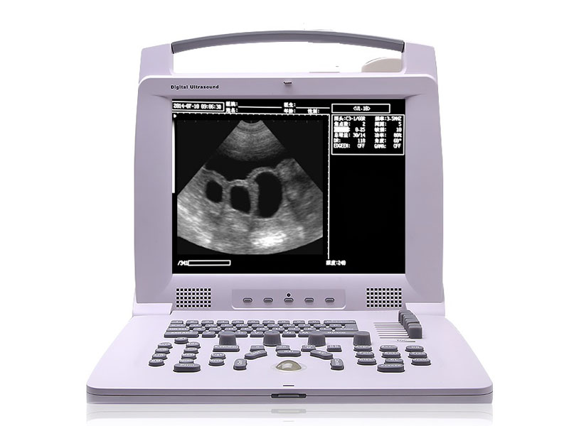 Veterinary Portable Ultrasound Scanner