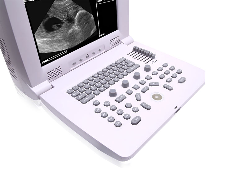 Veterinary Portable Ultrasound Scanner