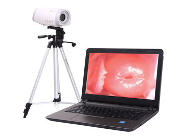 PL-9800 Portable Colposcope