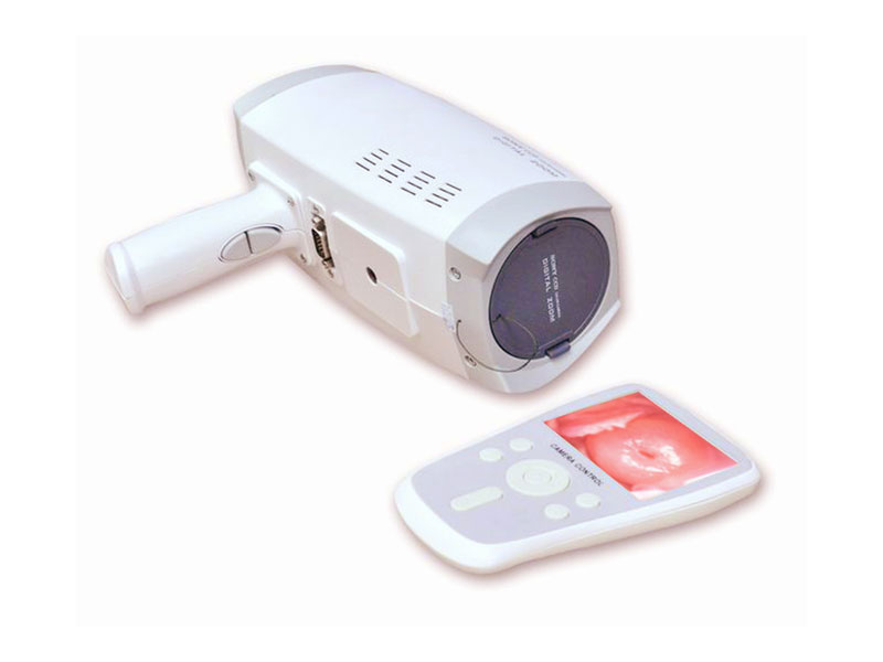 PL-9800B Handheld Video Colposcope